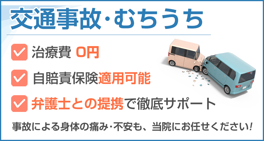 料金表（オファー）